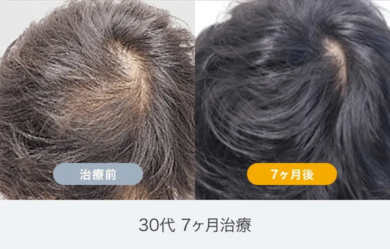 イースト駅前クリニック 広島院の症例写真