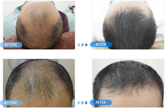 ラミュー広島中央クリニックの症例写真