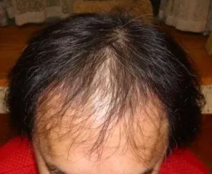 広島プルミエクリニックの症例写真治療前