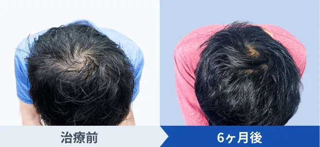 DMMオンラインクリニックの症例写真