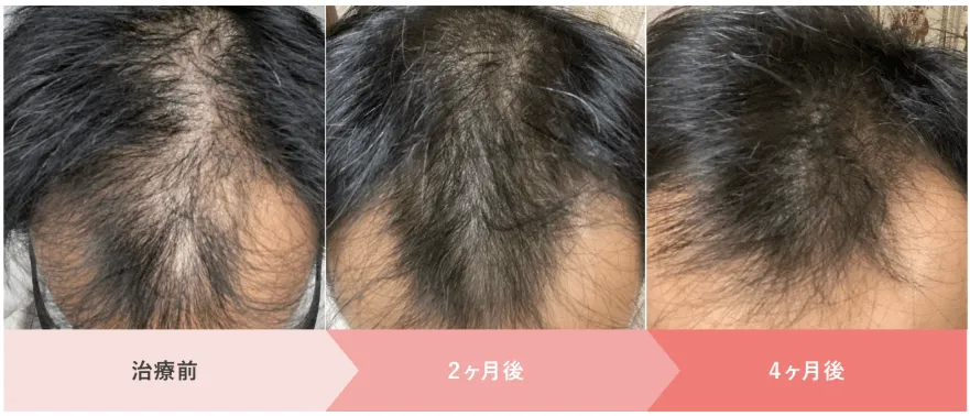 クリニックフォアの症例写真