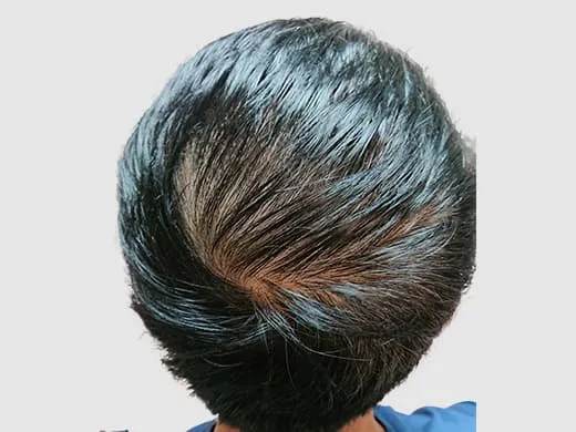 イースト駅前クリニックの症例写真治療前