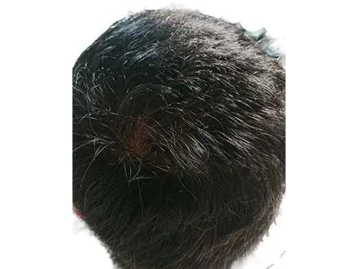 イースト駅前クリニックの症例写真7ヶ月後