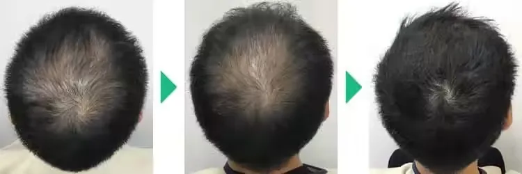 フィットクリニックの症例写真