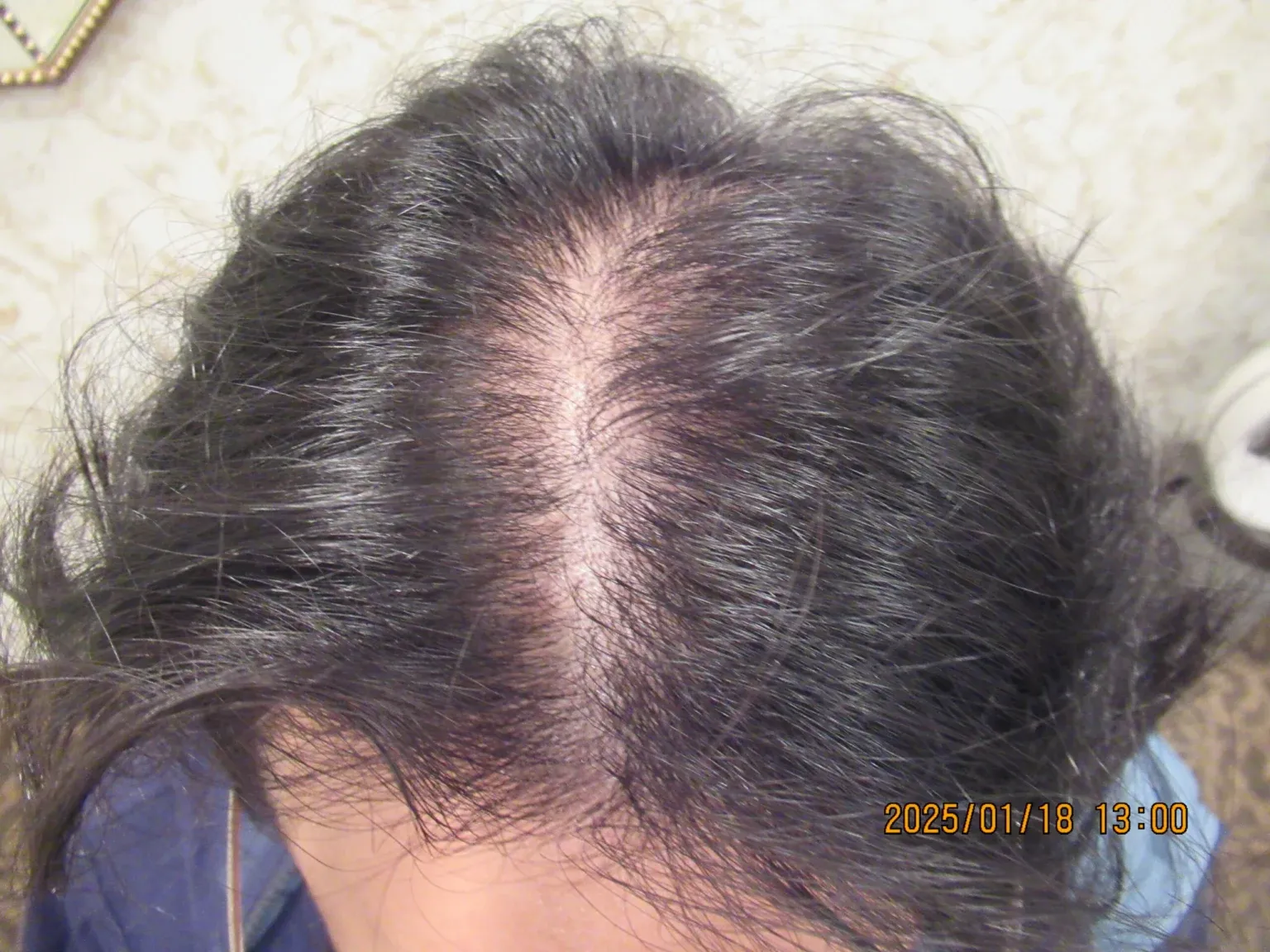 おもろまちヘア美容Clinicの症例写真治療前