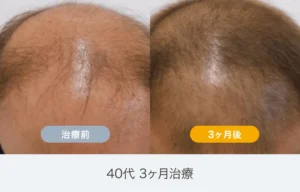 イースト駅前クリニック 仙台院の症例写真