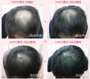 仙台中央クリニックの症例写真